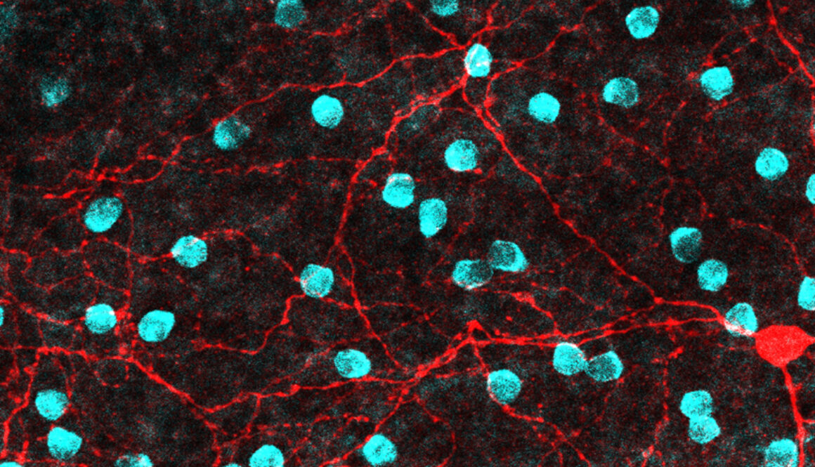 Sharshabeel Lab Shai Sabbah brain research Laboratory - Shai Sabbah Laboratory | Brain ...